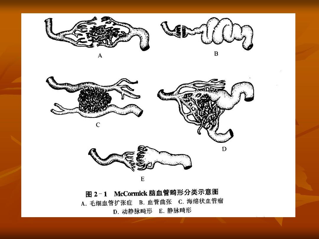 医学上的ccp_ccp在医学中是什么意思_医学ccpc是什么意思