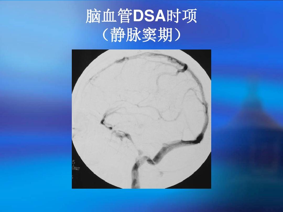 ccp在医学中是什么意思_医学ccpc是什么意思_医学上的ccp