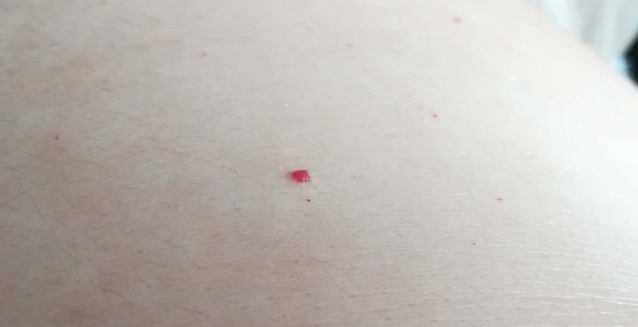 朱砂痣白月光是什么意思_朱砂痣白月光是什么意思_朱砂痣白月光是什么意思