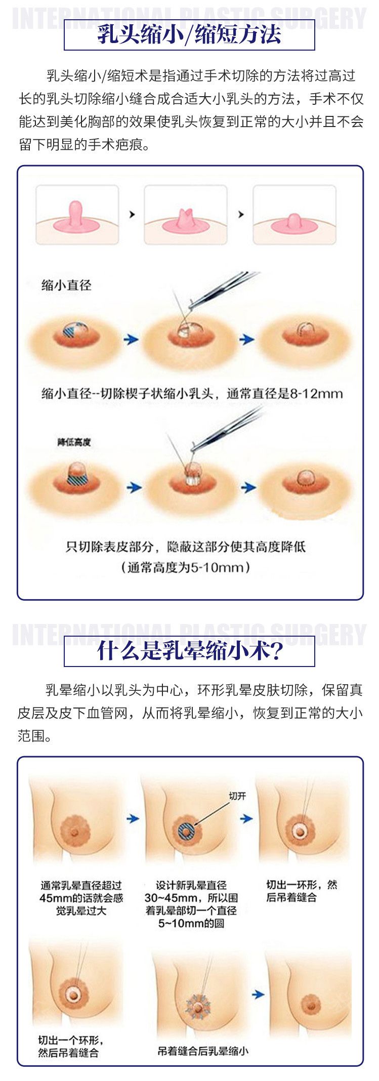 乳首特集_乳首特集_乳首特集