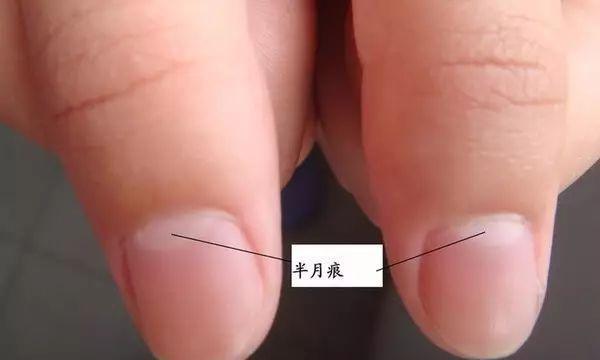 打游戏手机后盖发热正常吗_冰箱发热正常吗_小米3手机发热正常嘛