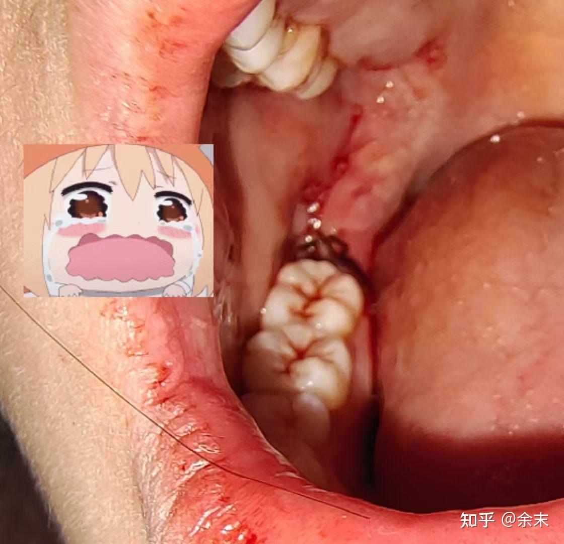 电影智齿为什么黑白_电影智齿剧情介绍_电影智齿